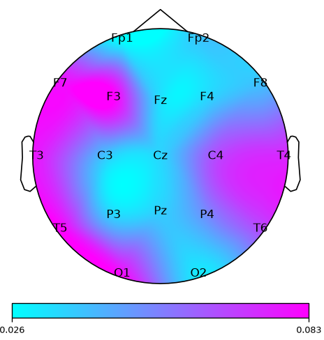Scalp map showing which electrode regions carried the most weight in one example recording